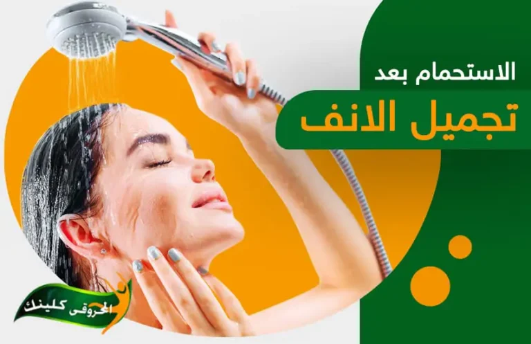 هل يجب الاستحمام بعد عملية تجميل الانف 1 الاستحمام بعد عملية تجميل الانف