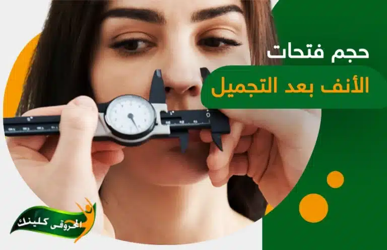 اختلاف حجم فتحات الأنف بعد التجميل عملية تنحيف الانف 13 اختلاف حجم فتحات الأنف بعد التجميل عملية تنحيف الانف