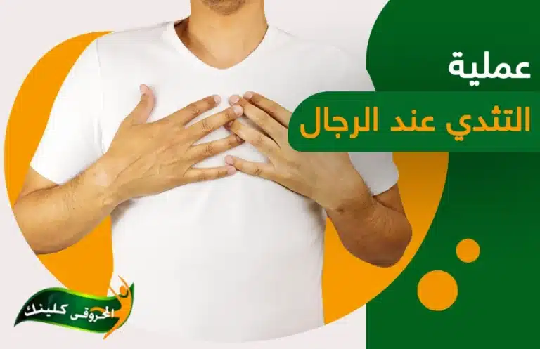 عملية التثدي عند الرجال… جراحة بسيطة بنتائج مذهلة 11 عملية التثدي عند الرجال