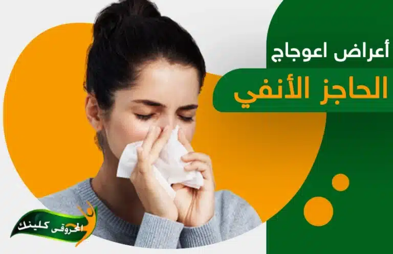 حتى لا تتفاقم أعراض اعوجاج الحاجز الأنفي.. عليكِ بهذه النصائح 9 أعراض اعوجاج الحاجز الأنفي