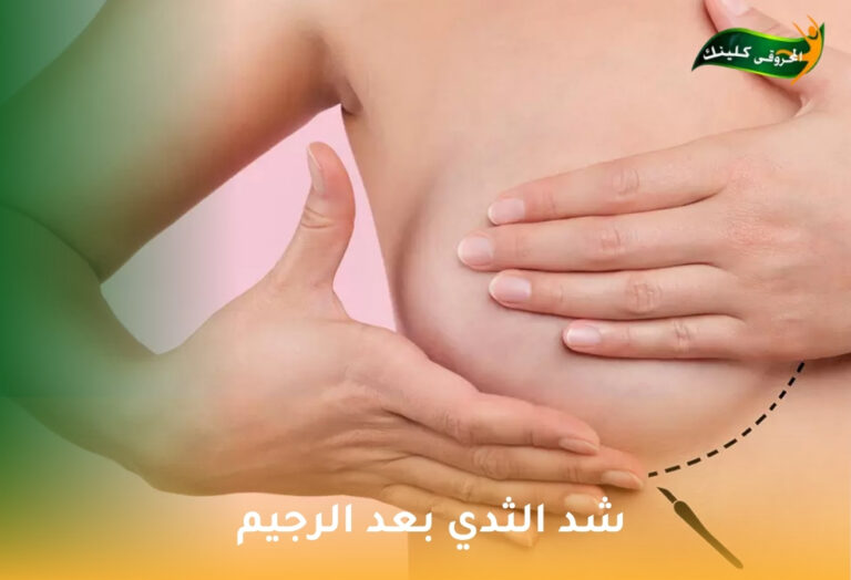 شد الثدي بعد الرجيم: استعادة القوام المتناسق والثقة بالنفس 7 شد الثدي بعد الرجيم