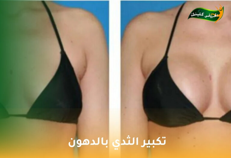 تكبير الثدي بالدهون: حل طبيعي لزيادة الحجم وتحسين القوام 1 تكبير الثدي بالدهون
