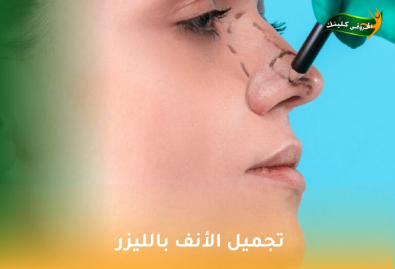 تجميل الأنف بالليزر: هل هو بديل للجراحة؟ 8 تجميل الأنف بالليزر