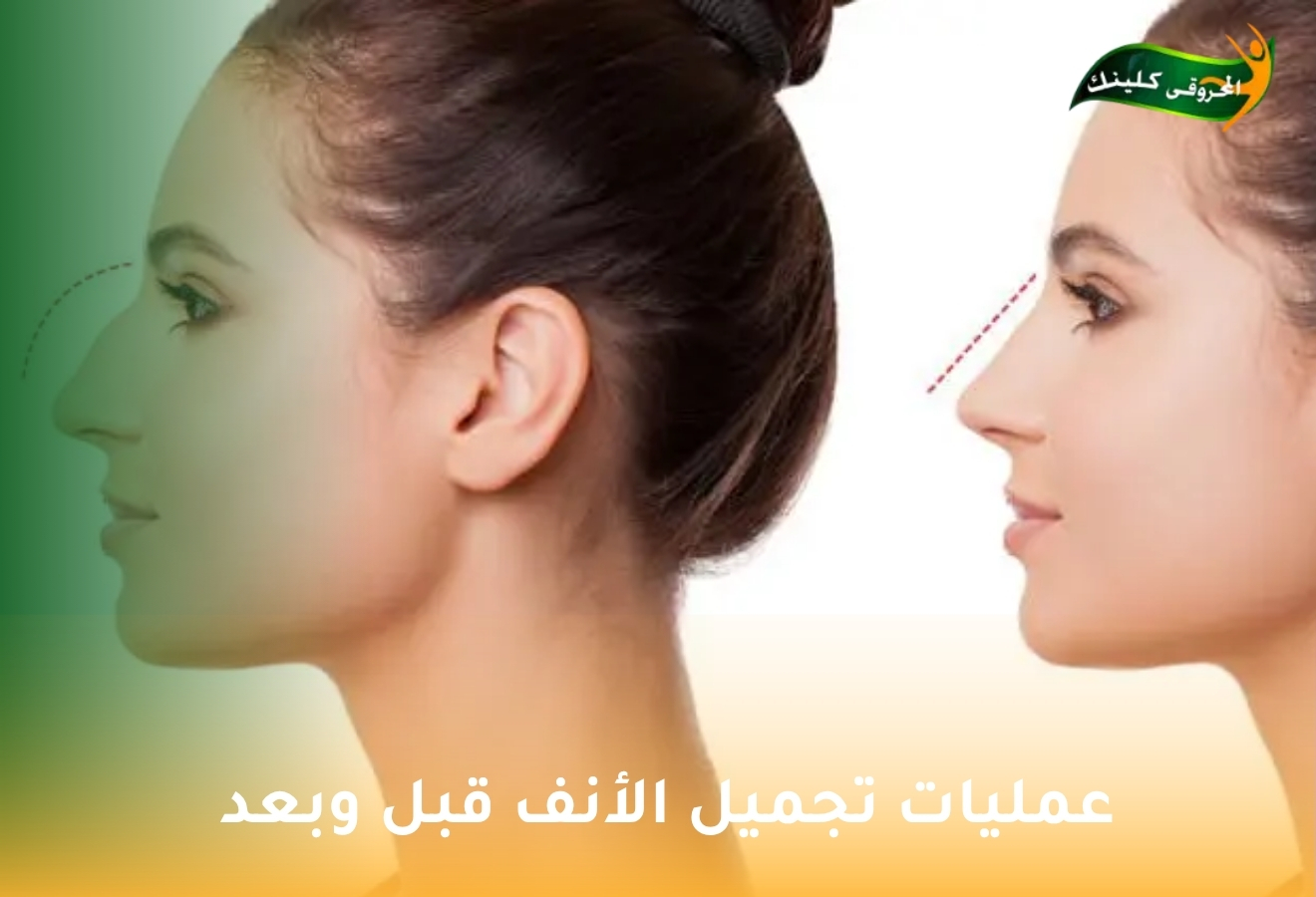 الصفحة الرئيسية 24 with title 40