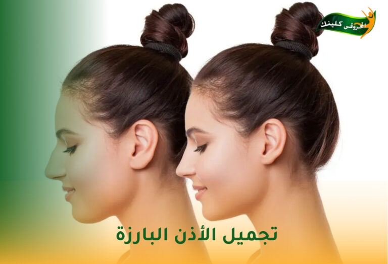 تجميل الأذن البارزة 9 تجميل الأذن البارزة