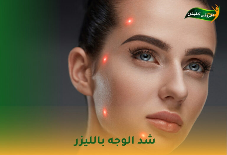شد الوجه بالليزر: تحول مذهل قبل وبعد 3 شد الوجه بالليزر