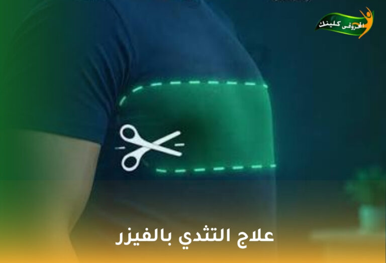 علاج التثدي بالفيزر 6 علاج التثدي بالفيزر