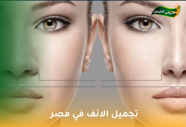تجميل الأنف في مصر: دليلك الشامل للحصول على مظهر متناسق وجذاب 5 تجميل الانف في مصر