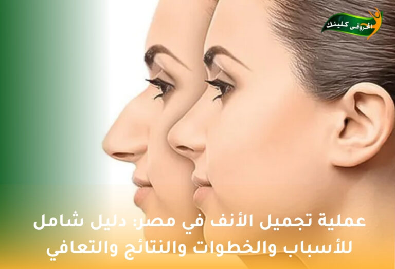 عملية تجميل الأنف في مصر: دليل شامل للأسباب والخطوات والنتائج والتعافي 4 عملية تجميل الأنف في مصر
