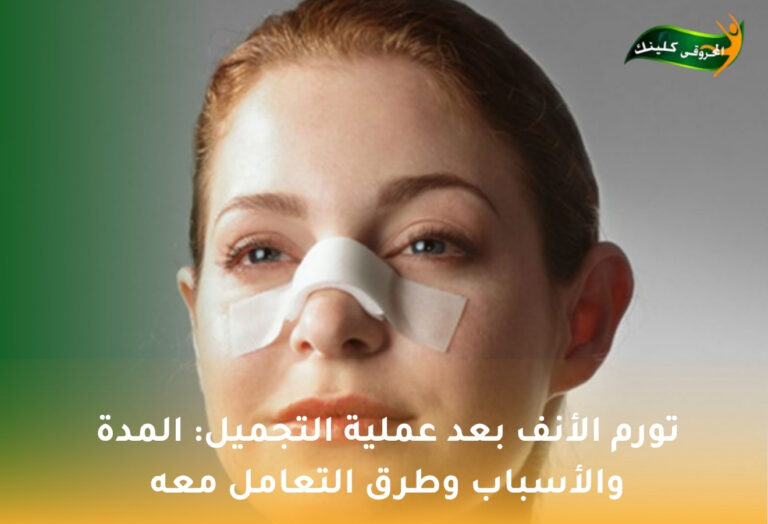 تورم الأنف بعد عملية التجميل: المدة والأسباب وطرق التعامل معه 2 تورم الأنف بعد عملية التجميل