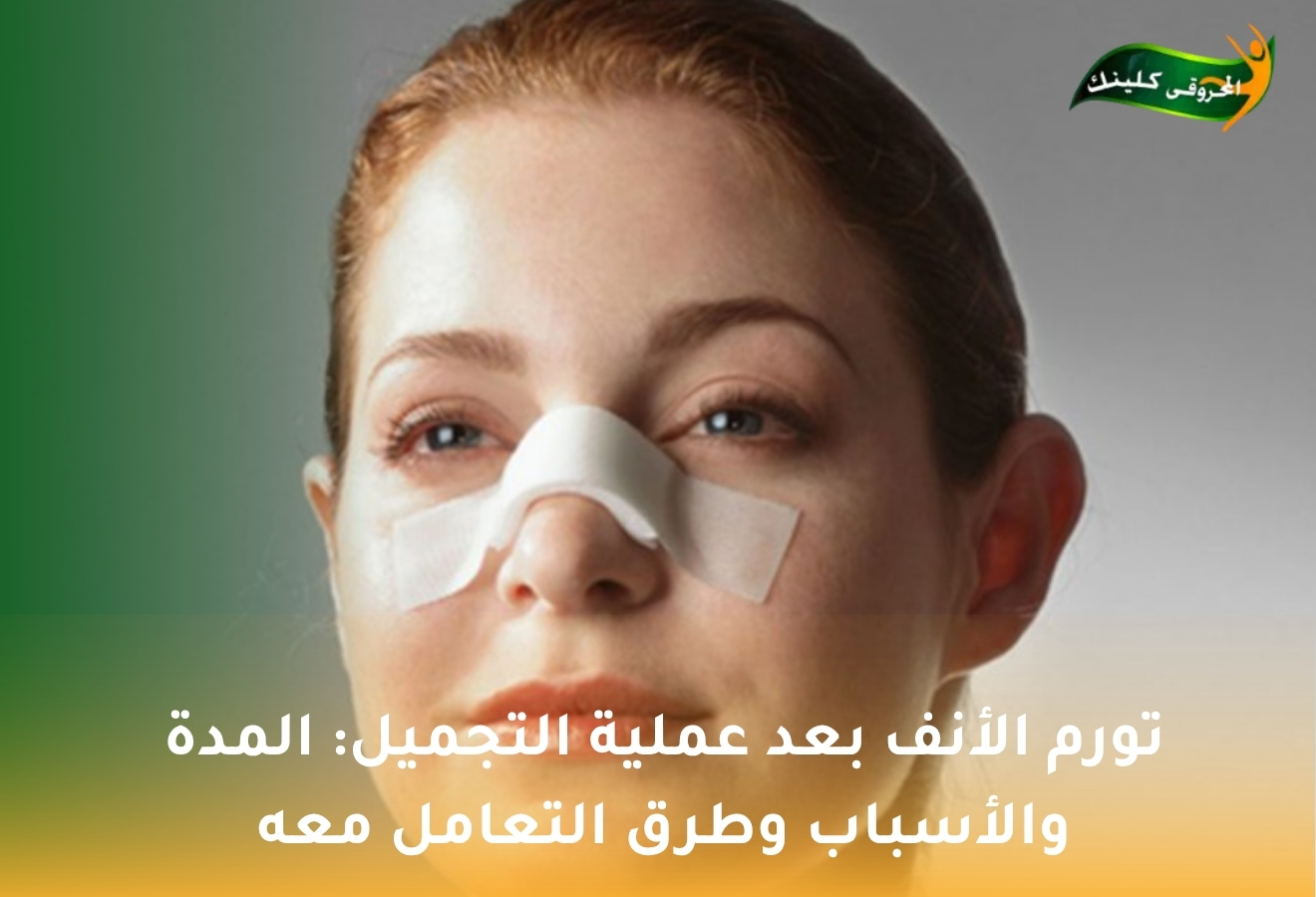 تورم الأنف بعد عملية التجميل: المدة والأسباب وطرق التعامل معه 1 تورم الأنف بعد عملية التجميل