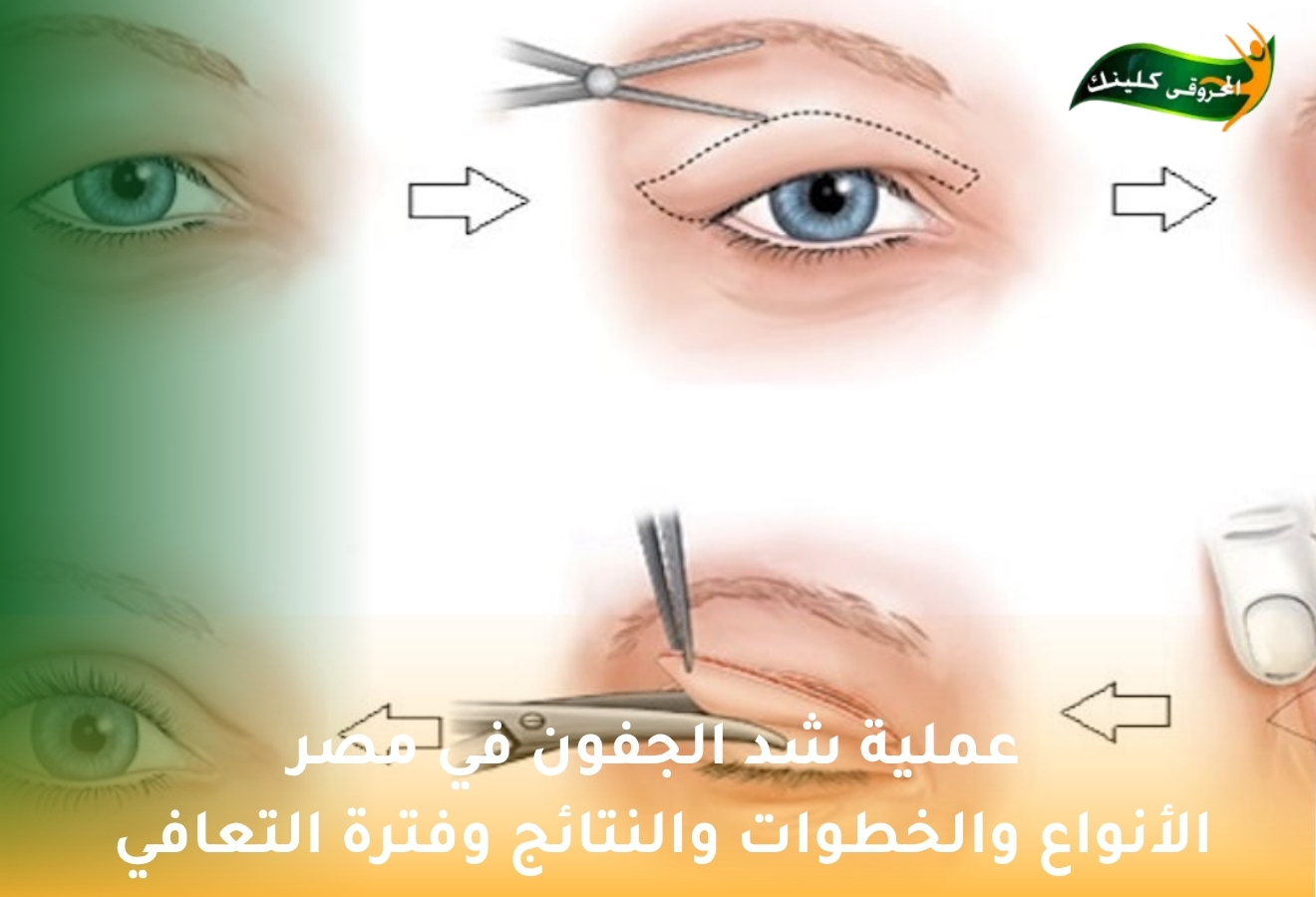 الصفحة الرئيسية 26 with title 45