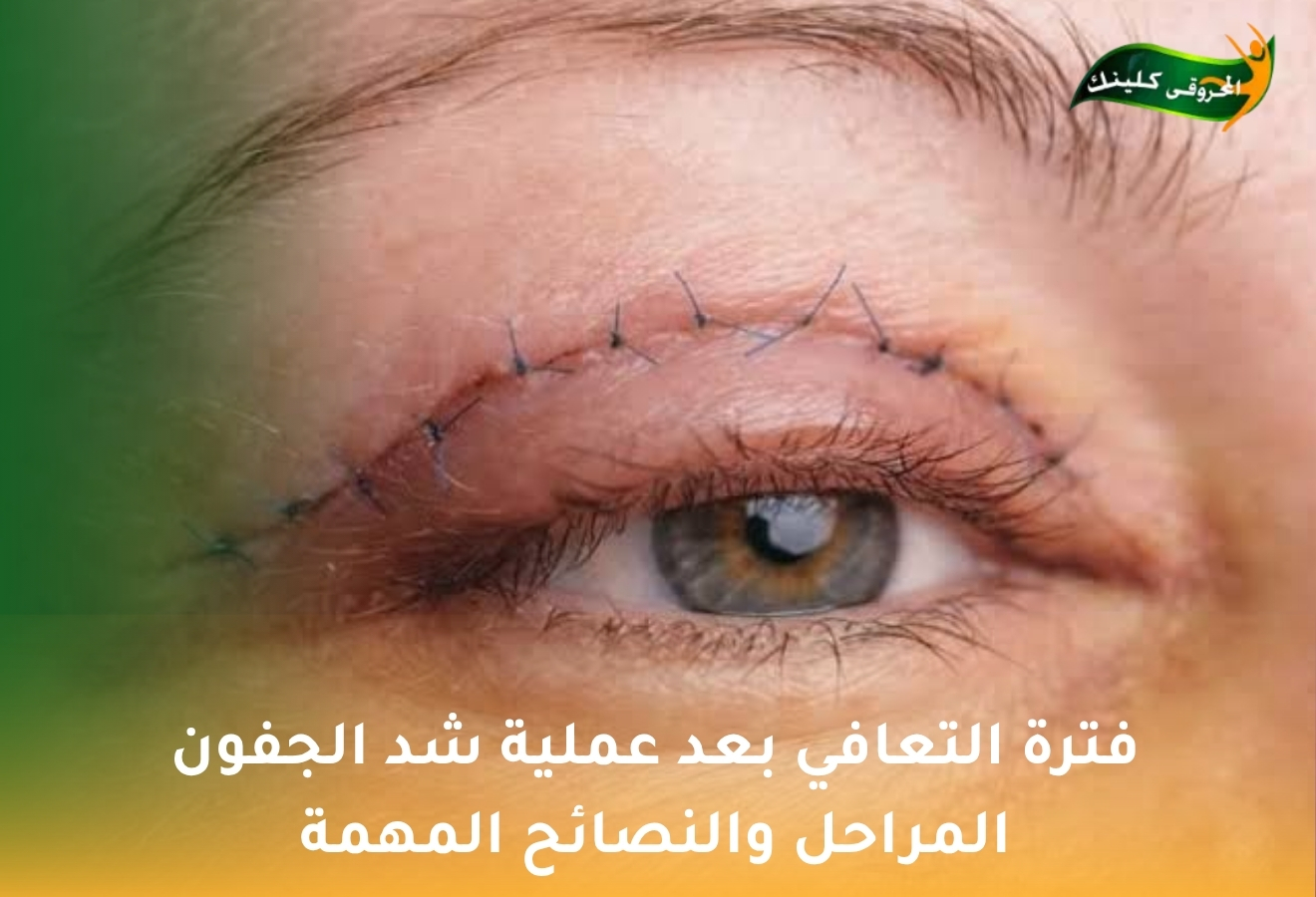 الصفحة الرئيسية 25 with title 46