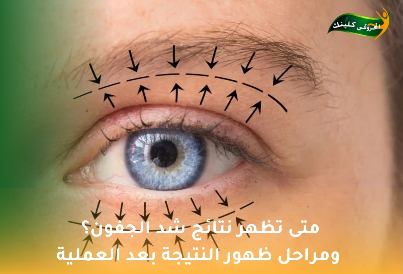 الصفحة الرئيسية 24 with title 47