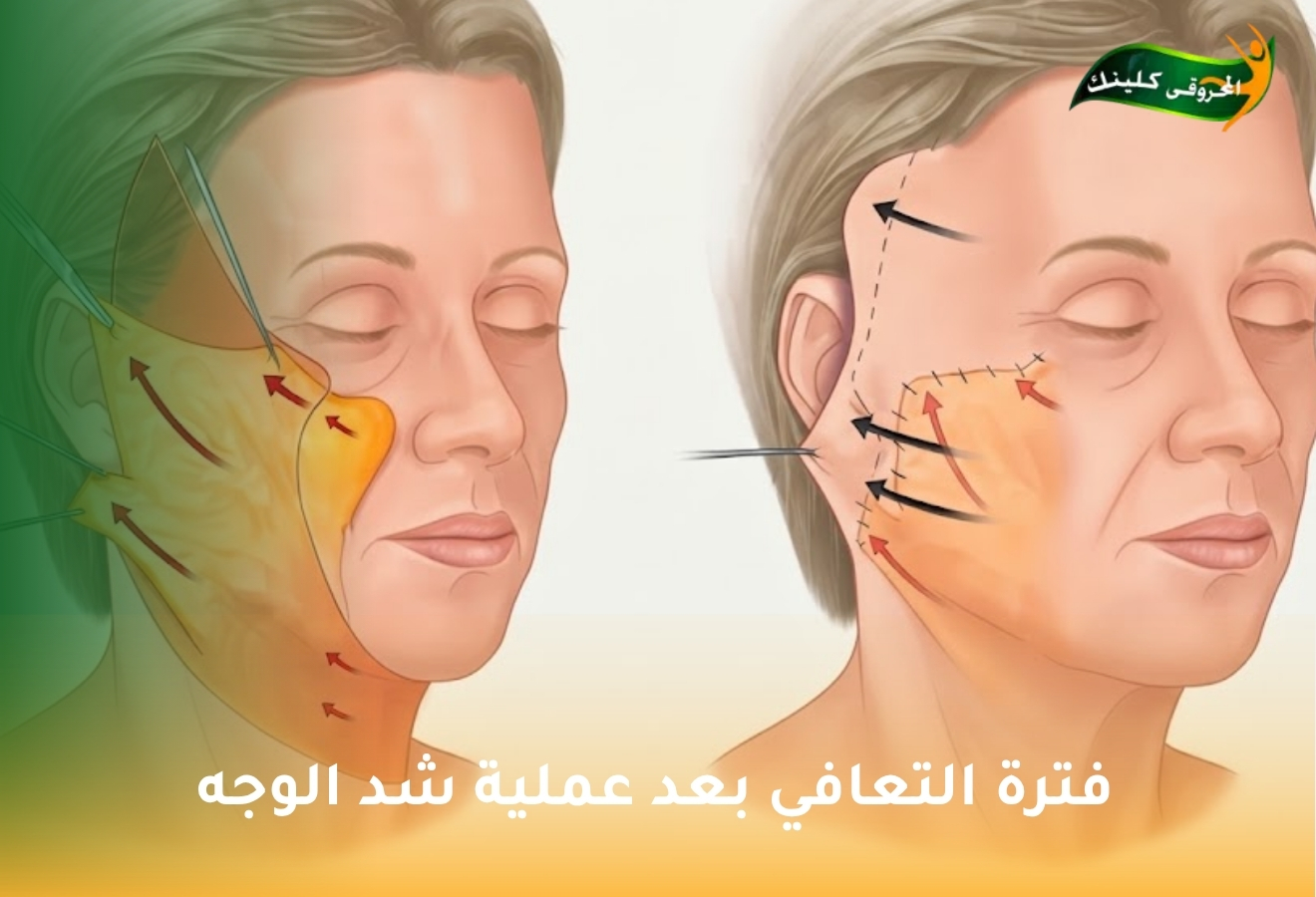 الصفحة الرئيسية 21 with title 51