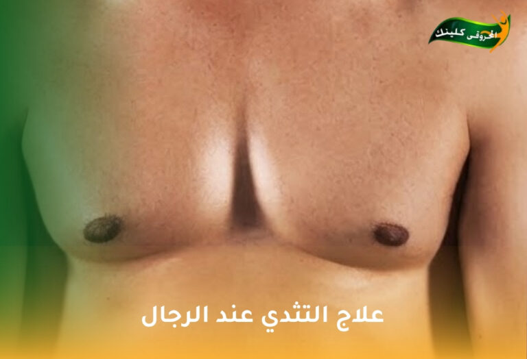 علاج التثدي عند الرجال 4 علاج التثدي عند الرجال