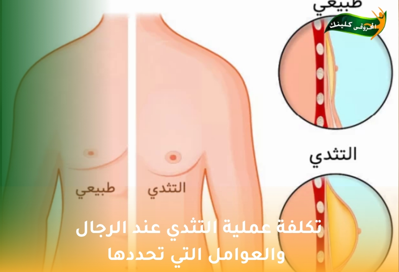 تكلفة عملية التثدي عند الرجال والعوامل التي تحددها 1 تكلفة عملية التثدي عند الرجال